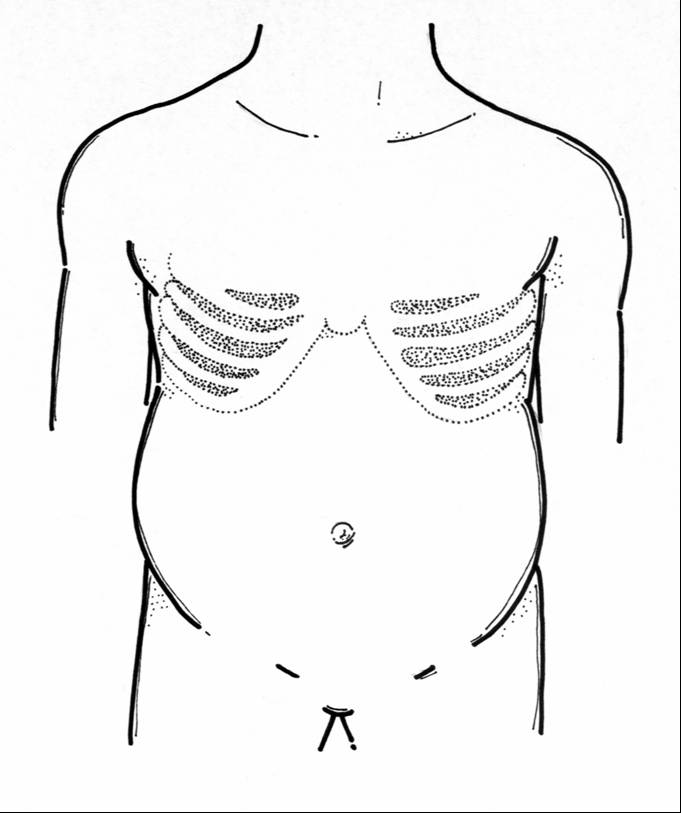 高階腹腔鏡手術在本院的突破(相關圖片)