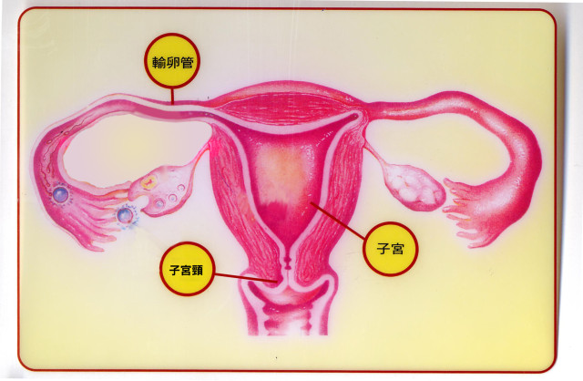 婦癌遠離我系列一 婦女朋友們注意子宮頸癌的可怕(相關圖片)