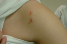 微創關節鏡手術的新趨勢  (相關圖片)