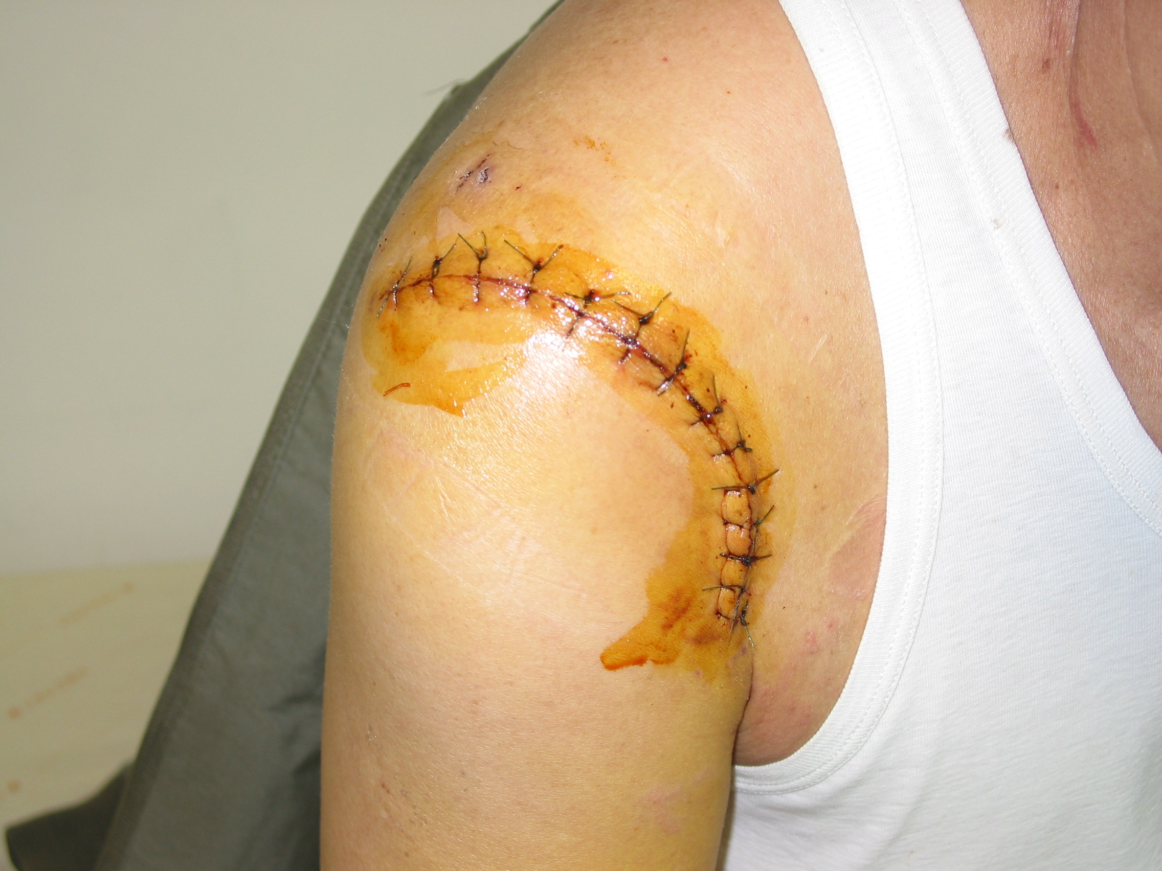 微創關節鏡手術的新趨勢  (相關圖片)