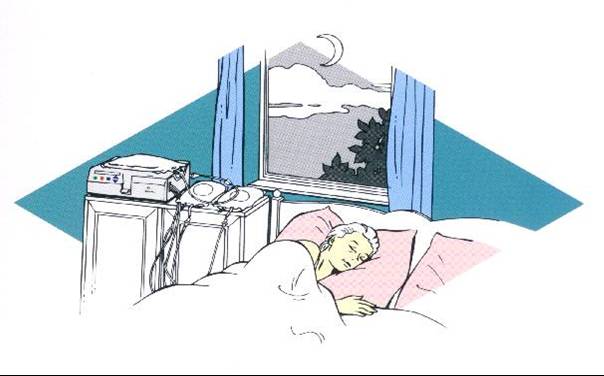 腎衰竭患者的另類選擇----腹膜透析(相關圖片)