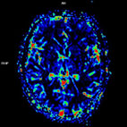 快速磁振造影在全身影像檢查的應用 (相關圖片)