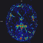 快速磁振造影在全身影像檢查的應用 (相關圖片)