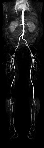 快速磁振造影在全身影像檢查的應用 (相關圖片)