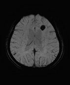 快速磁振造影在全身影像檢查的應用 (相關圖片)