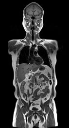 快速磁振造影在全身影像檢查的應用 (相關圖片)