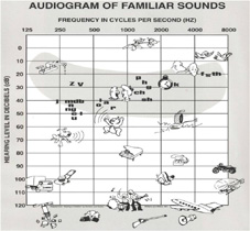 聽不清楚怎麼辦? 老年性聽力障礙(相關圖片)