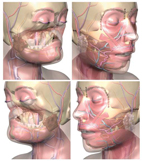 顏面移植-陌生人的臉  變成我的明天(相關圖片)