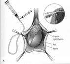 不孕症   男人你也有責任(相關圖片)
