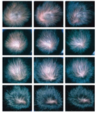 男性禿頭的煩惱(相關圖片)