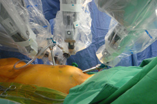 機器人開刀的時代來了! 達文西手術系統(Da Vinci surgery system)-讓大手術不等於大傷口(相關圖片)