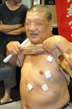 機器人開刀的時代來了! 達文西手術系統(Da Vinci surgery system)-讓大手術不等於大傷口(相關圖片)