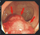 老人便秘知多少(相關圖片)