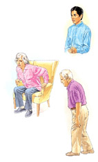 瞭解巴金森氏症   Q&A解碼(相關圖片)