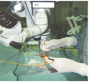 淺談飛蚊症(相關圖片)