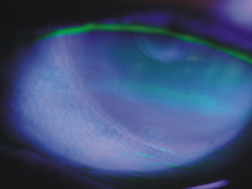 如何讓眼睛不再乾澀  介紹乾眼症(相關圖片)