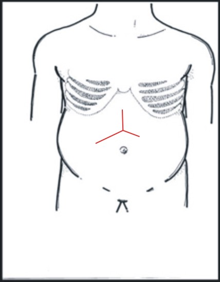 肝癌的診斷及治療(相關圖片)