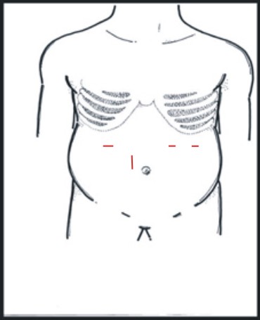 肝癌的診斷及治療(相關圖片)