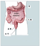 戰勝大腸癌(相關圖片)
