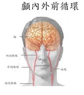 天氣冷颼颼  腦中風預防與治療(相關圖片)