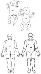 爆竹傷害「報」你知(相關圖片)