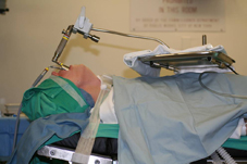 喉顯微手術簡介(相關圖片)