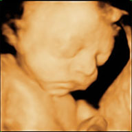 可愛寶貝3D影像照介紹(相關圖片)