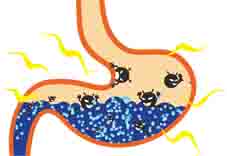 正確用藥保『胃』戰(相關圖片)