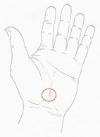 腕隧道症候群(相關圖片)