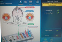 現代頭頸外科手術的神經守護『神經偵測儀』(相關圖片)