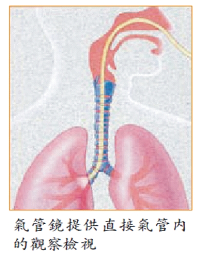 我不是林黛玉，為何卻咳血   淺談咳血的處置原則(相關圖片)