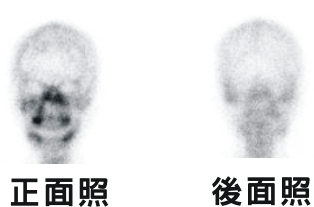 『傳統核醫檢查』的再進化(相關圖片)