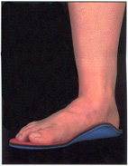 鴨母腳蹄  談『兒童扁平足』(相關圖片)