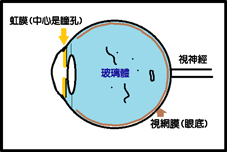 眼前怎麼有蚊子？淺談『飛蚊症』(相關圖片)