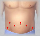 達文西接力賽  6個小傷口切除『兩種癌與膽結石』(相關圖片)