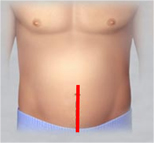 達文西接力賽  6個小傷口切除『兩種癌與膽結石』(相關圖片)