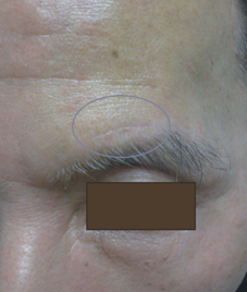 『微創神經外科手術』的介紹(相關圖片)