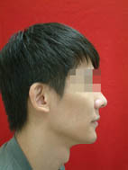 『齒顎矯正』  讓美觀更有自信(相關圖片)