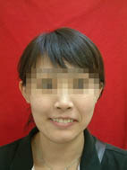 『齒顎矯正』  讓美觀更有自信(相關圖片)