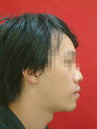 『齒顎矯正』  讓美觀更有自信(相關圖片)