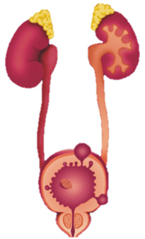 男人小心 憋出泌尿疾病(相關圖片)