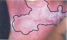 菸酒檳榔不離口  疾病盯上我   (相關圖片)