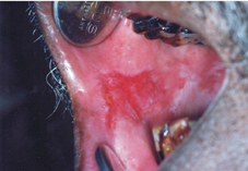 菸酒檳榔不離口  疾病盯上我   (相關圖片)