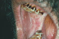 菸酒檳榔不離口  疾病盯上我   (相關圖片)