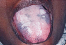 菸酒檳榔不離口  疾病盯上我   (相關圖片)