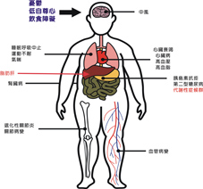 肥胖兒童也會有脂肪肝?(相關圖片)