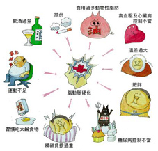 你是腦中風候選人嗎？(相關圖片)