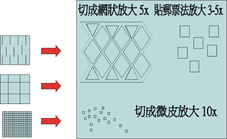 大面積燒傷之加護照顧(相關圖片)