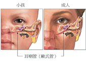 談耳咽管功能異常(相關圖片)