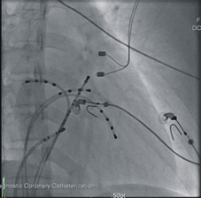 心律不整與電氣生理燒灼術(相關圖片)